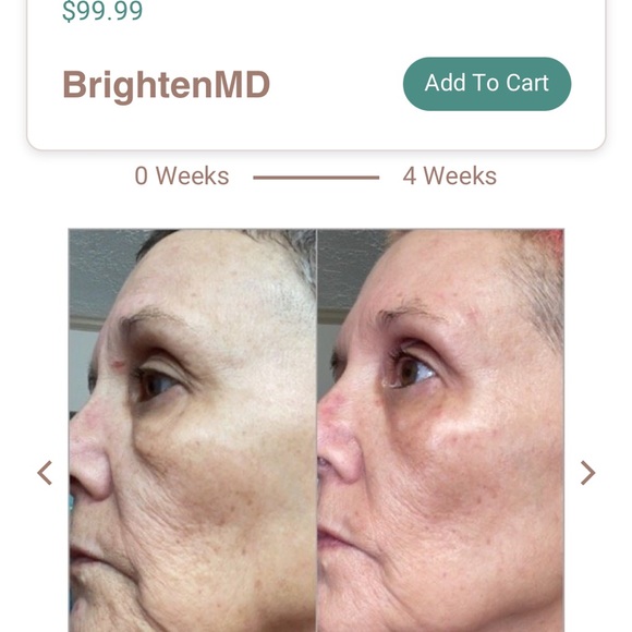 - Trophy Skin Brighten MD - Picture 4 of 12